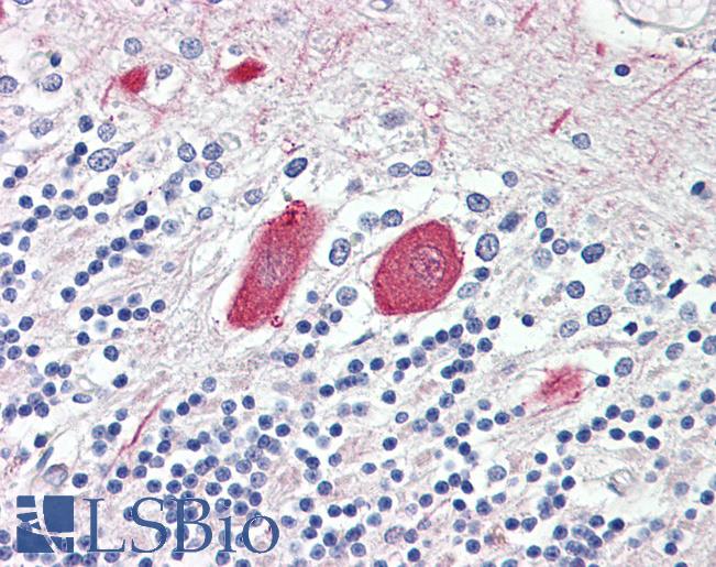 Anti-MTNR1B antibody IHC of human brain, cerebellum. Immunohistochemistry of formalin-fixed, paraffin-embedded tissue after heat-induced antigen retrieval. Antibody LS-B7370 concentration 3.75 ug/ml.