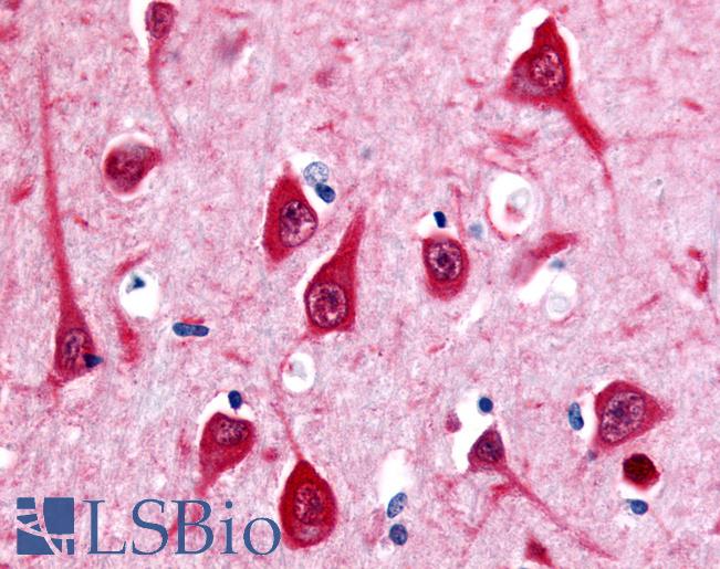 Anti-MTNR1B antibody LS-A933 IHC of human brain, hippocampus. Immunohistochemistry of formalin-fixed, paraffin-embedded tissue after heat-induced antigen retrieval.