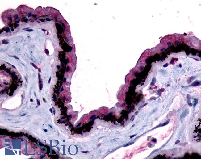 Anti-MTNR1B antibody LS-A930 IHC of human eye, retina. Immunohistochemistry of formalin-fixed, paraffin-embedded tissue after heat-induced antigen retrieval.