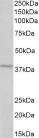 MC4R antibody (2 ug/ml) staining of MCF7 lysate (35 ug protein in RIPA buffer). Primary incubation was 1 hour. Detected by chemiluminescence.