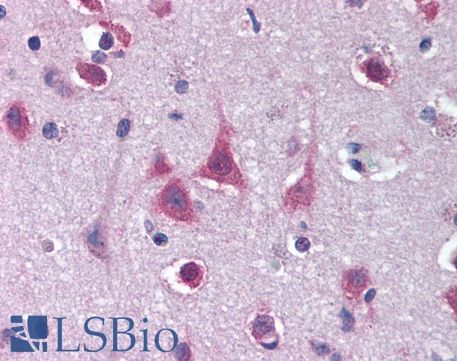 Anti-MTO1 antibody IHC of human brain, cortex. Immunohistochemistry of formalin-fixed, paraffin-embedded tissue after heat-induced antigen retrieval. Antibody LS-B1830 concentration 20 ug/ml.