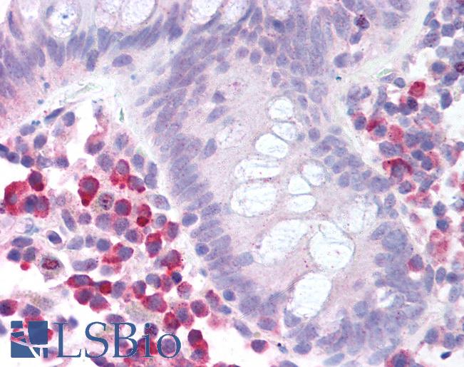 Anti-MTOR antibody IHC of human colon. Immunohistochemistry of formalin-fixed, paraffin-embedded tissue after heat-induced antigen retrieval. Antibody LS-B1354 concentration 5 ug/ml.