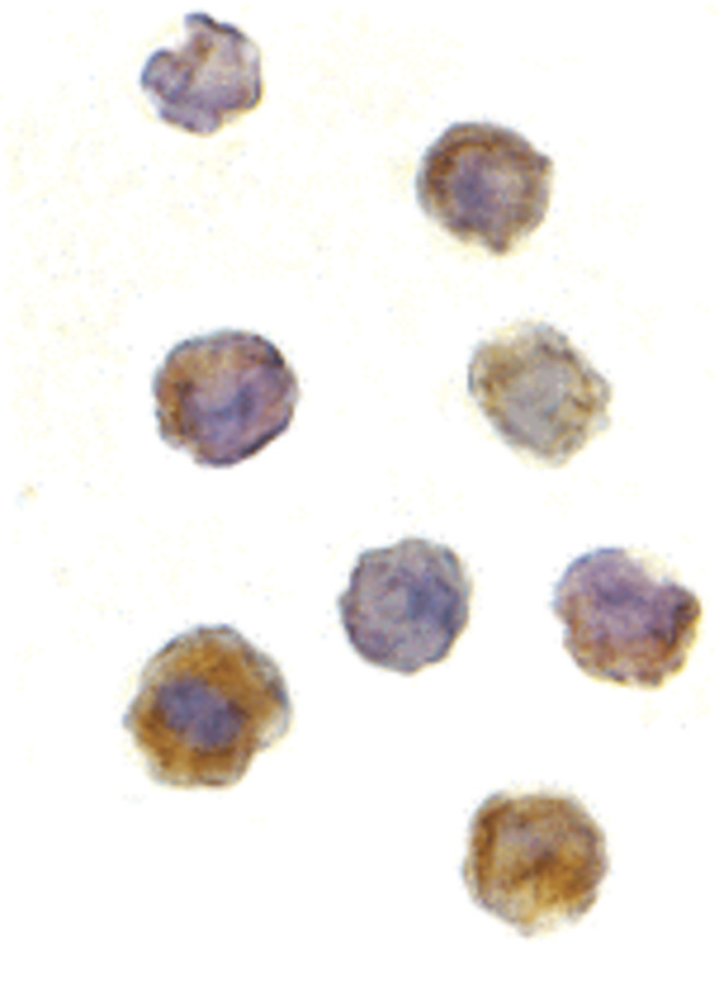 Immunocytochemistry of TOR in L1210 cells with TOR antibody at 2 ug/ml.