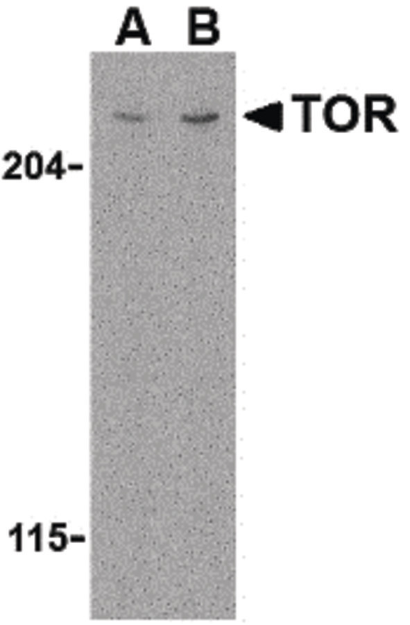 Western blot of TOR in L1210 cell lysate with TOR antibody at (A) 1 and (B) 2 ug/ml.