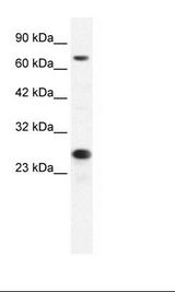HepG2 Cell Lysate