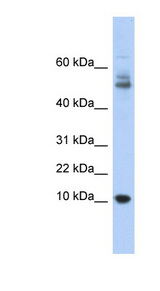 MTPN antibody LS-C111440 Western blot of Fetal Thymus lysate.