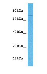 Western blot of MTRR Antibody with human HeLa Whole Cell lysate.