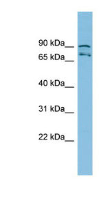 MTRR antibody LS-C116725 Western blot of HepG2 cell lysate.