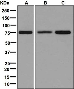Western blot analysis on (A) HeLa, (B) BxPC-3, and (C) 293T cell lysates using anti-MTRR antibody.