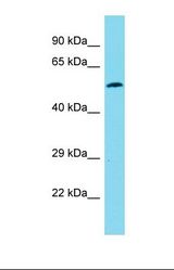 Western blot of 721_B. MYL10 antibody dilution 1.0 ug/ml.