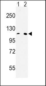 Western blot of MTTP Antibody in HeLa(lane 1), 293(lane 2) cell line lysates (35 ug/lane). MTTP (arrow) was detected using the purified antibody.