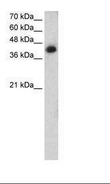 Jurkat Cell Lysate