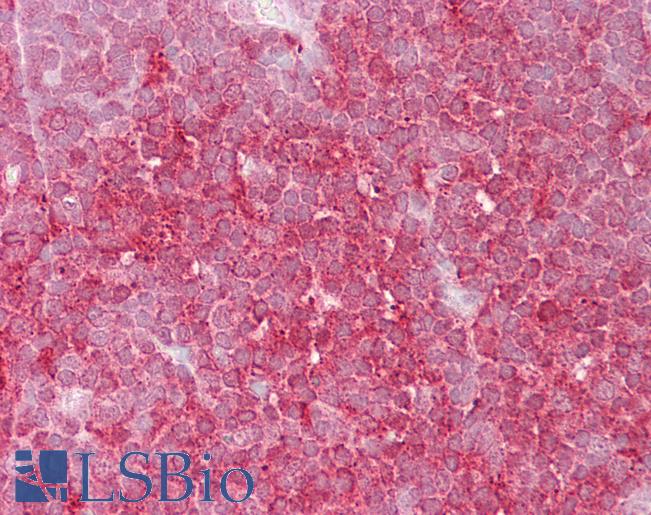 Anti-MCM6 antibody IHC of human thymus. Immunohistochemistry of formalin-fixed, paraffin-embedded tissue after heat-induced antigen retrieval. Antibody LS-B6803 concentration 5 ug/ml.