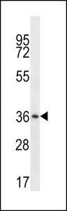 MUL1 Antibody western blot of human placenta tissue lysates (35 ug/lane). The MUL1 antibody detected the MUL1 protein (arrow).