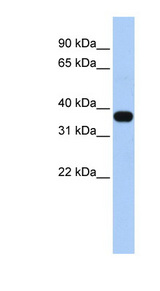 MUL1 / C1orf166 antibody LS-C102020 Western blot of Fetal Heart lysate.