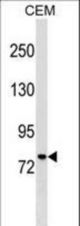 MUM1 Antibody western blot of CEM cell line lysates (35 ug/lane). The MUM1 antibody detected the MUM1 protein (arrow).