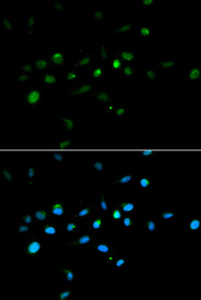 Immunofluorescence analysis of A549 cell using TRIM63 antibody. Blue: DAPI for nuclear staining.