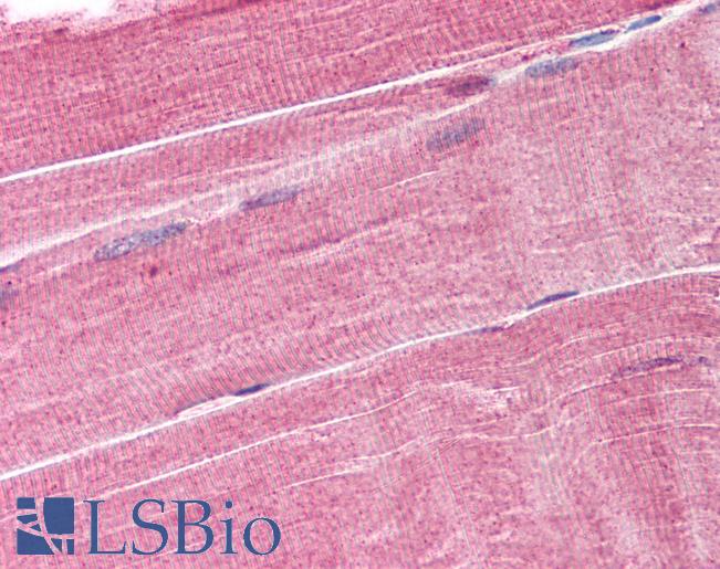 Anti-TRIM63 / MURF1 antibody IHC of human skeletal muscle. Immunohistochemistry of formalin-fixed, paraffin-embedded tissue after heat-induced antigen retrieval. Antibody LS-B1751 concentration 25 ug/ml.
