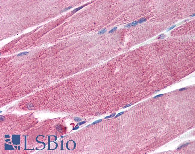 Anti-TRIM63 / MURF1 antibody IHC of human skeletal muscle. Immunohistochemistry of formalin-fixed, paraffin-embedded tissue after heat-induced antigen retrieval. Antibody LS-B1750 concentration 25 ug/ml.