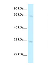 MUS81 antibody LS-C145507 Western blot of A549 Cell lysate. Antibody concentration 1 ug/ml.