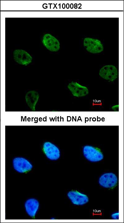 Immunofluorescence of paraformaldehyde-fixed HeLa using MUS81 antibody at 1:100 dilution.