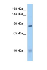 MUSK antibody LS-C146062 Western blot of HeLa Cell lysate. Antibody concentration 1 ug/ml.