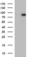 HEK293T cells were transfected with the pCMV6-ENTRY control (Left lane) or pCMV6-ENTRY MUT (Right lane) cDNA for 48 hrs and lysed. Equivalent amounts of cell lysates (5 ug per lane) were separated by SDS-PAGE and immunoblotted with anti-MUT.
