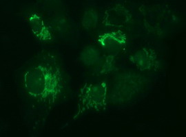 Anti-MUT mouse monoclonal antibody immunofluorescent staining of COS7 cells transiently transfected by pCMV6-ENTRY MUT.