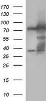 HEK293T cells were transfected with the pCMV6-ENTRY control (Left lane) or pCMV6-ENTRY MUT (Right lane) cDNA for 48 hrs and lysed. Equivalent amounts of cell lysates (5 ug per lane) were separated by SDS-PAGE and immunoblotted with anti-MUT.