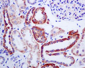 IHC of paraffin-embedded human kidney tissue using anti-MUT antibody.