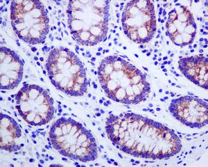 IHC of paraffin-embedded human colon tissue using anti-MUT antibody.