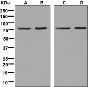 Western blot analysis on (A) HeLa, (B) K562, (C) 293T, and (D) fetal liver lysates using anti-MUT antibody.