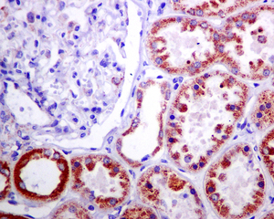 IHC of paraffin-embedded human kidney tissue using anti-MUT antibody.