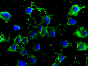 Immunofluorescent staining of HeLa cells using anti-MUT antibody.