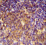 MUTED Antibody immunohistochemistry of formalin-fixed and paraffin-embedded human tonsil tissue followed by peroxidase-conjugated secondary antibody and DAB staining.