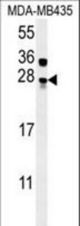 MUTED Antibody western blot of MDA-MB435 cell line lysates (15 ug/lane). The MUTED antibody detected MUTED protein (arrow).