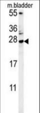 MUTED Antibody western blot of mouse bladder tissue lysates (15 ug/lane). The MUTED antibody detected MUTED protein (arrow).