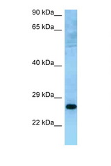 MUTED antibody LS-C146319 Western blot of HeLa Cell lysate. Antibody concentration 1 ug/ml.