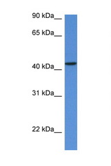 MVD antibody LS-C135919 Western blot of Fetal Heart lysate. Antibody concentration 1 ug/ml.