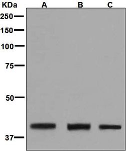 Western blot analysis on (A) fetal liver, (B) K562, and (C) HepG2 lysates using anti-MVD antibody.