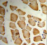 Formalin-fixed and paraffin-embedded human Skeletal muscle reacted with MVD Antibody , which was peroxidase-conjugated to the secondary antibody, followed by DAB staining. This data demonstrates the use of this antibody for immunohistochemistry; clinical relevance has not been evaluated.