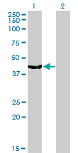 Western Blot analysis of MVD expression in transfected 293T cell line by MVD monoclonal antibody (M01), clone 2A7.Lane 1: MVD transfected lysate(43.4 KDa).Lane 2: Non-transfected lysate.