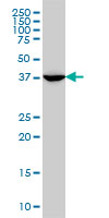 MVD monoclonal antibody (M01), clone 2A7 Western Blot analysis of MVD expression in A-431.