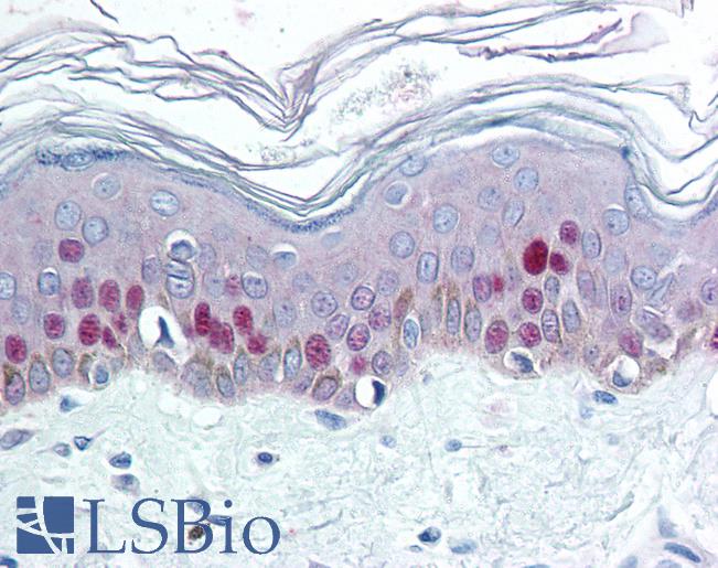 Anti-MCM7 antibody IHC of human skin. Immunohistochemistry of formalin-fixed, paraffin-embedded tissue after heat-induced antigen retrieval. Antibody LS-B2009 dilution 1:50.