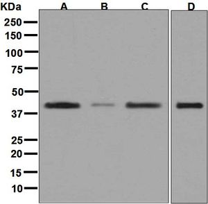 Western blot analysis on (A) HepG2, (B) Jurkat, (C) Caco-2, and (D) fetal liver lysates using anti-MVK antibody.
