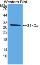 Western blot of recombinant MX1 / MX.