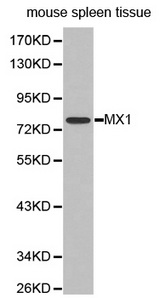 Western blot analysis of extracts of mouse spleen tissue, using MX1 antibody.