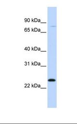 Hela cell lysate. Antibody concentration: 1.0 ug/ml. Gel concentration: 12%.