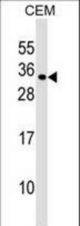 MXD1 Antibody western blot of CEM cell line lysates (35 ug/lane). The MXD1 antibody detected the MXD1 protein (arrow).