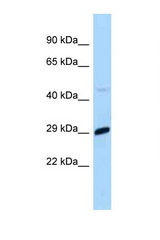 MXD1 / MAD antibody LS-C146083 Western blot of Mouse Liver lysate. Antibody concentration 1 ug/ml.